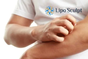 prevent your actinic keratoses Buckinghamshire getting worse - call our team today!