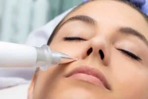 Actinic keratoses Buckinghamshire solutions - book in today!